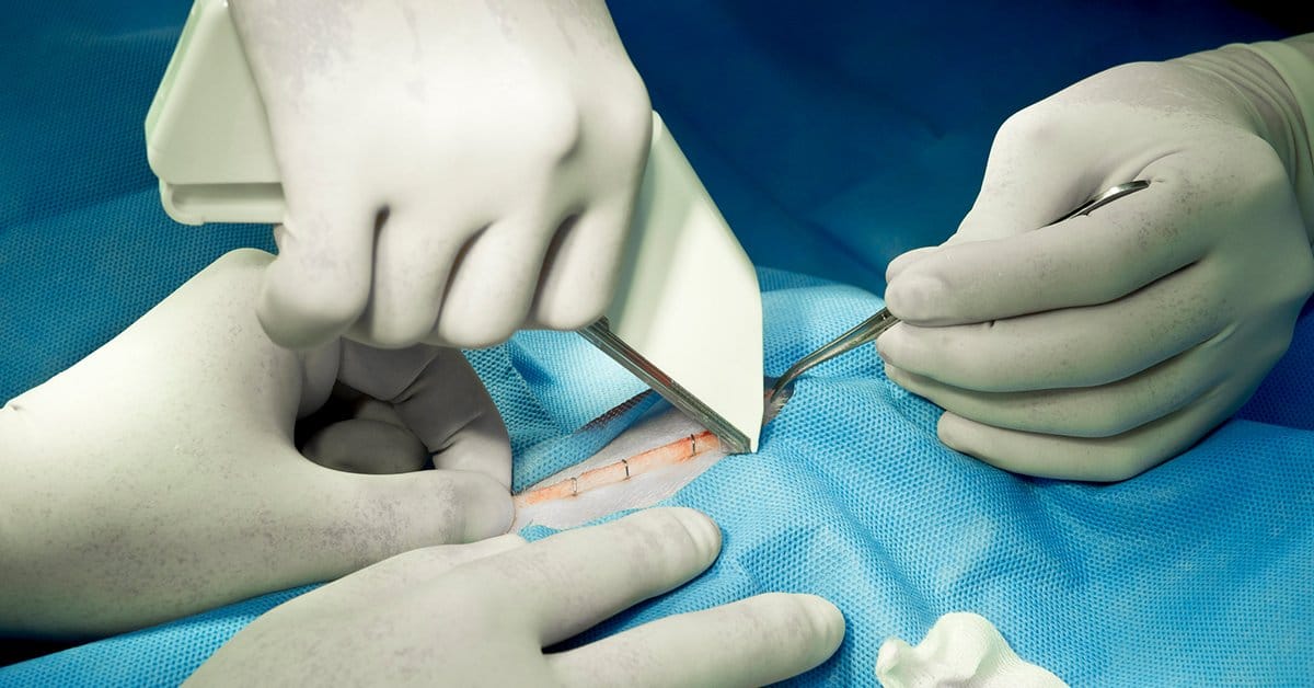 Surgical Staplers Counsel Hound